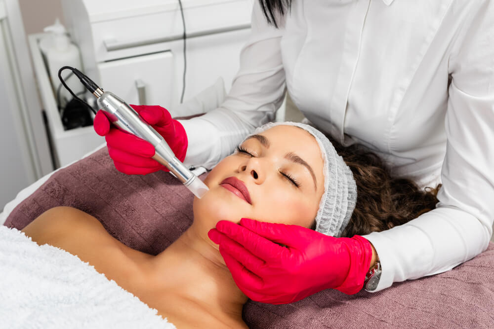 Beautiful woman receiving microneedling rejuvenation treatment.